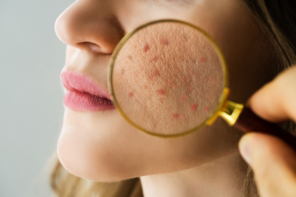 Dermatologia Clínica: Cuidados essenciais para a saúde da sua pele