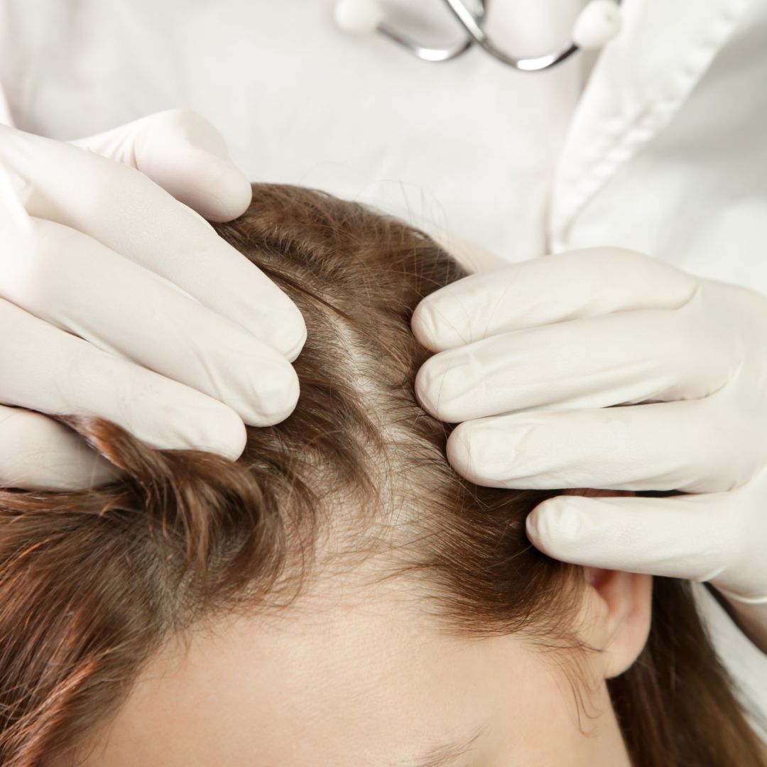 Dermatologista examinando o couro cabeludo de um paciente, verificando a saúde capilar.