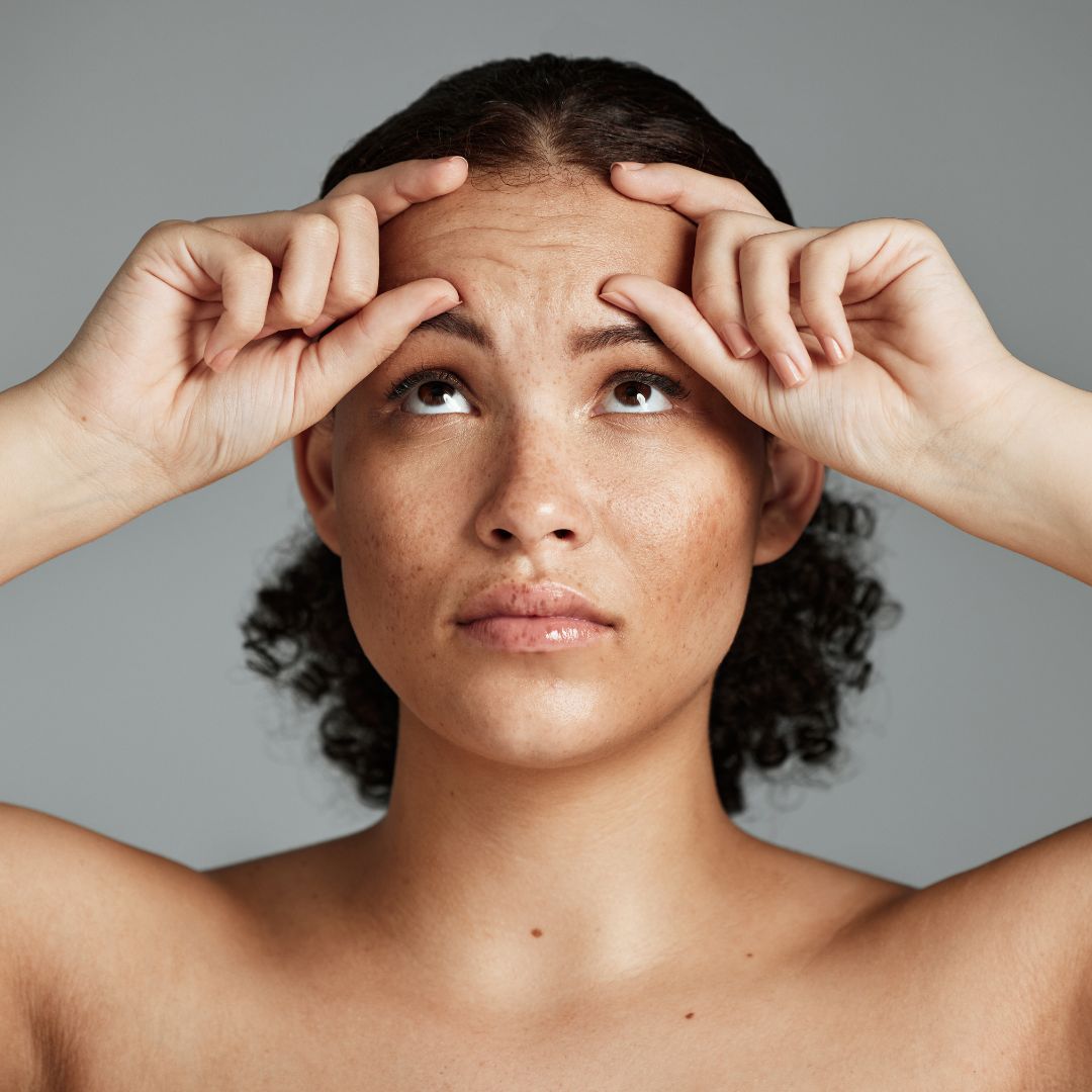 Mulher negra analisando suas rugas faciais para tratamento por botox