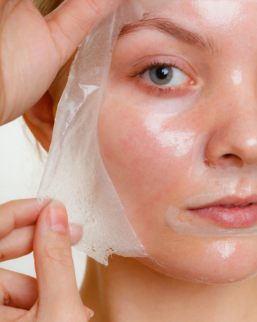 Mulher removendo pele após tratamentos de peeling