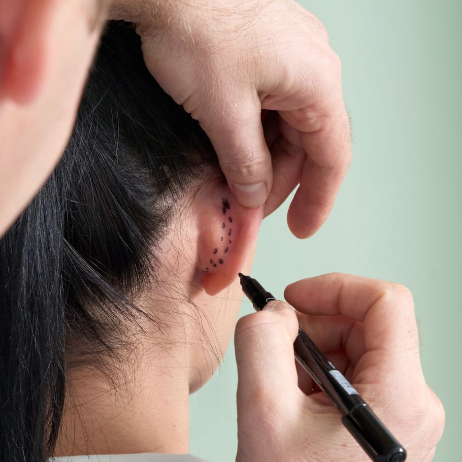 Cirurgião plástico examinando orelha de paciente antes de cirurgia plástica otoplastia para cirurgia de correção de orelhas
