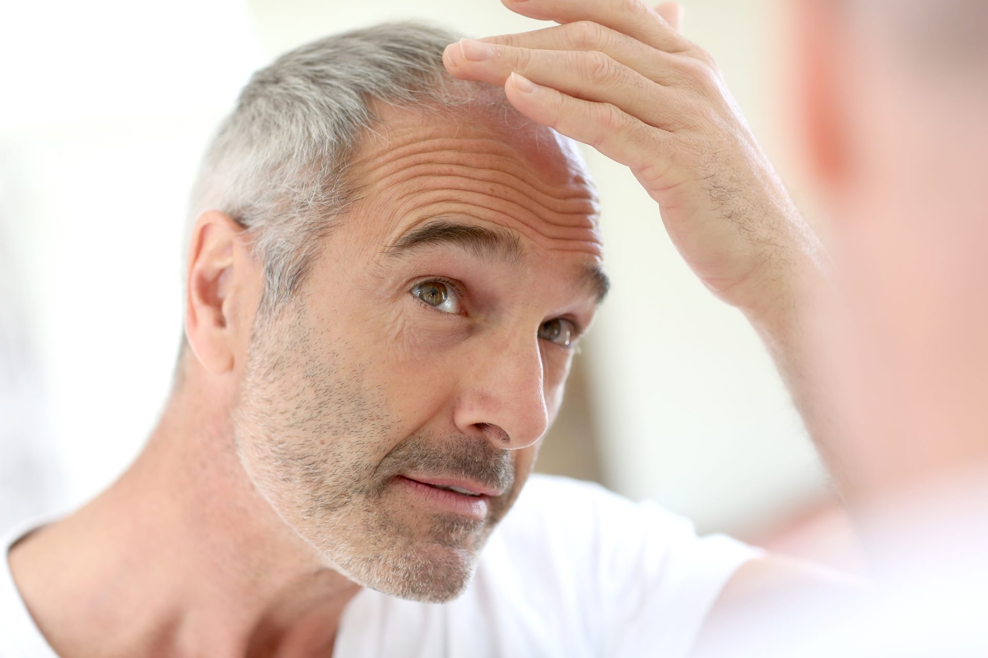 Tratamentos estéticos para homens com problema de queda de cabelo em clínica de dermatologia e estética