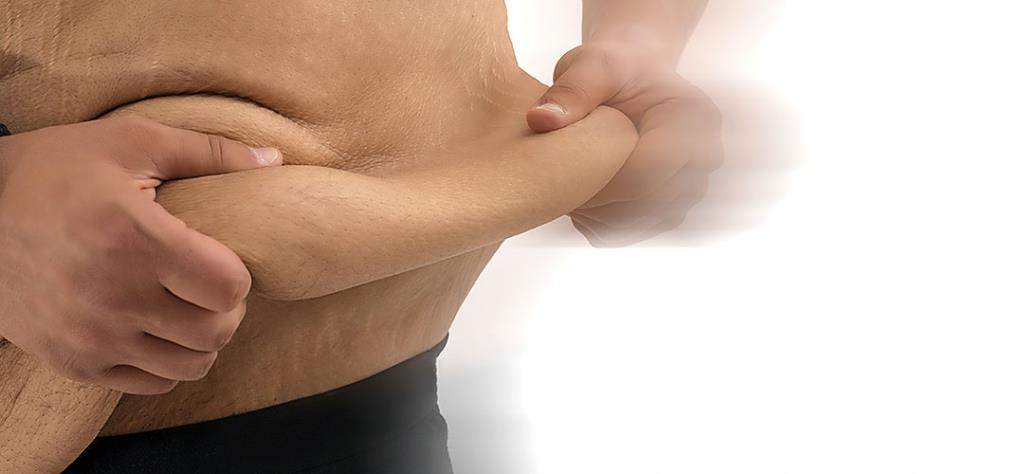 Remove excesso de pele e flacidez após grande perda de peso. Procedimentos: abdominoplastia, mamoplastia, lifting de braços e coxas. Feitas isoladas ou combinadas, conforme cada paciente.