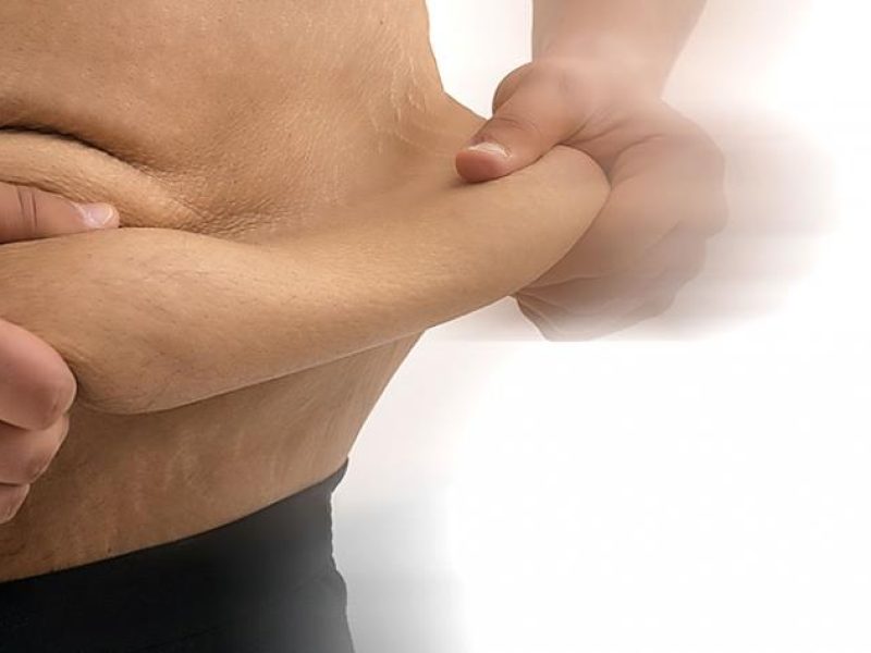 Remove excesso de pele e flacidez após grande perda de peso. Procedimentos: abdominoplastia, mamoplastia, lifting de braços e coxas. Feitas isoladas ou combinadas, conforme cada paciente.